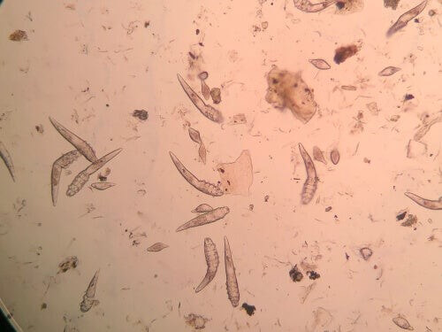 Hårsækmider er meget meget mikroskopiske 
