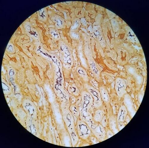 Leptospirose under et mikroskop