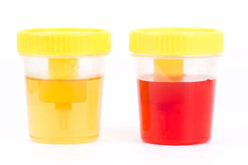 Qu’indique la présence de sang dans l’urine du chien ?