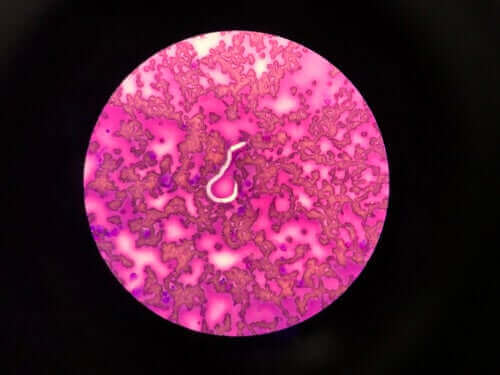 Mikroskopisk bilde av hjerteorm