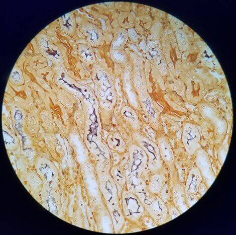 Et mikroskopbilde av leptospirose