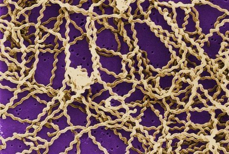 Et mikroskopisk bilde av leptospirose hos katter