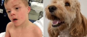 Rodzinny pies ratuje chorego na zespół Downa chłopca