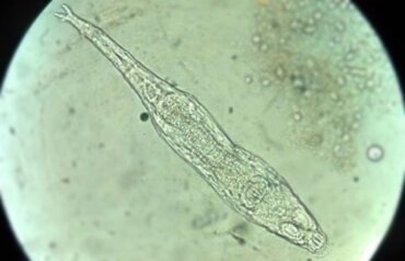 Bdelloidea: mikroorganizm sprzed 24 000 lat powraca do życia