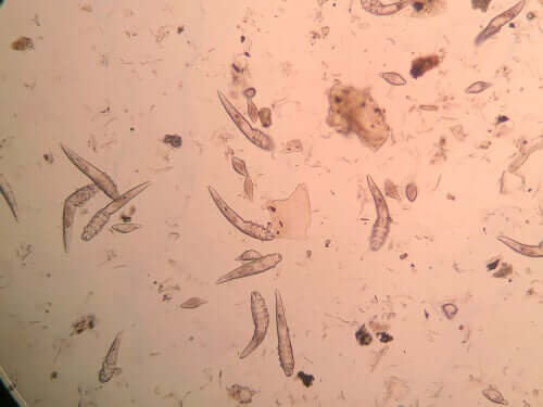 Mikroskopiska parasiter