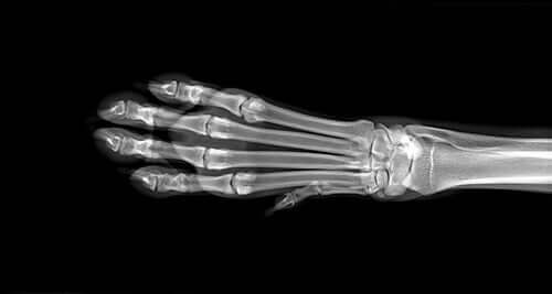 Röntgenbild på en hunds ben.