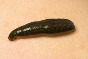 Hirudo Medicinalis: The Medicinal Leech
