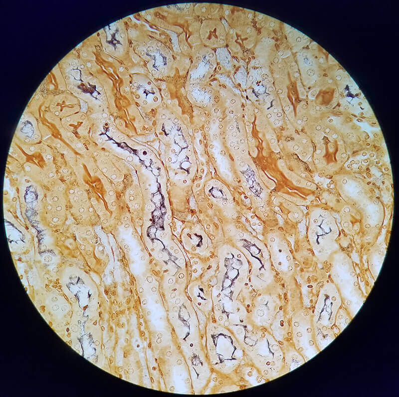 A microscope image of leptospirosis.