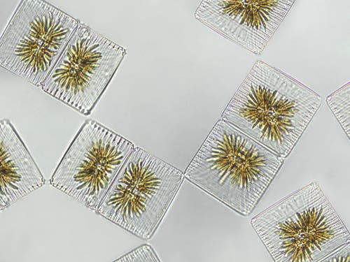 Phytoplankton under a microscope.