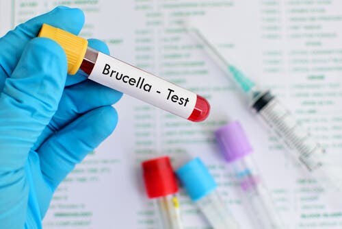 A test tube with blood labeled with a disease.