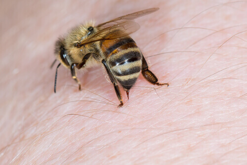 Bee stings are one of many insect bites.