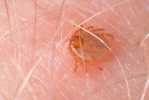 A tick on a person's skin.