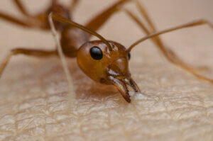 What Are the Most Dangerous Stings?