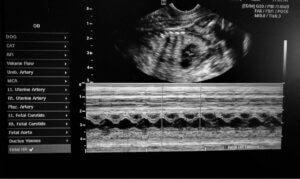 Ultrasound of a pregnant dog.